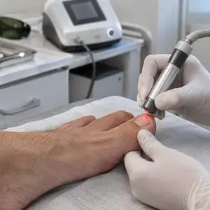 Laserterapia para os pés na Aos Pés Podologia