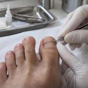 Tratamento com ortose na Aos Pés Podologia